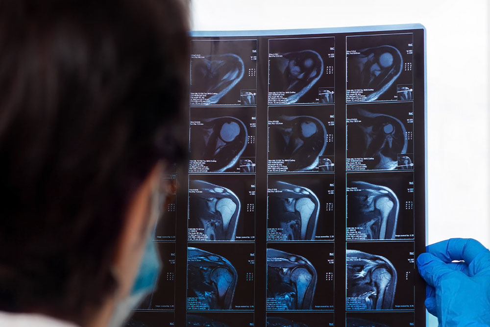 Magnetic resonance imaging (MRI) and ultrasound